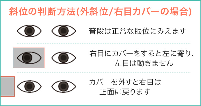 斜位の判断方法